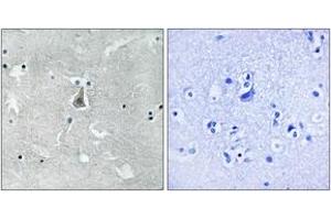 Immunohistochemistry analysis of paraffin-embedded human brain, using Bax (Phospho-Ser184) Antibody. (BAX antibody  (pSer184))