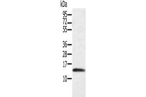 Gel: 12 % SDS-PAGE, Lysate: 40 μg, Lane: Human placenta tissue, Primary antibody: ABIN7130526(PAGE1 Antibody) at dilution 1/200, Secondary antibody: Goat anti rabbit IgG at 1/8000 dilution, Exposure time: 3 minutes (PAGE1 antibody)