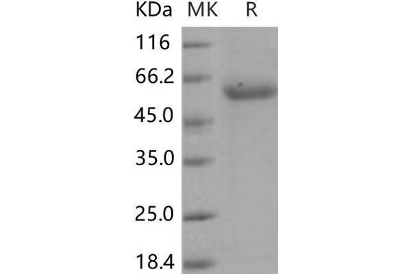 ENPP7 Protein (His tag)
