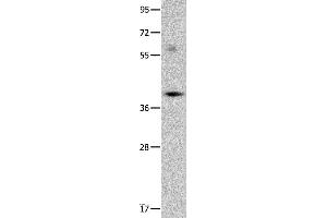 Western blot analysis of Mouse brain tissue, using OPCML Polyclonal Antibody at dilution of 1:400 (OPCML antibody)