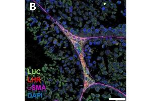 Immunofluorescence (Paraffin-embedded Sections) (IF (p)) image for anti-Luteinizing Hormone/Choriogonadotropin Receptor (LHCGR) (C-Term) antibody (ABIN2857013)