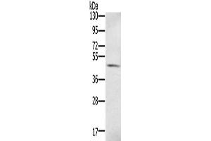 Gel: 8 % SDS-PAGE, Lysate: 40 μg, Lane: Human fetal brain tissue, Primary antibody: ABIN7130962(S100PBP Antibody) at dilution 1/350, Secondary antibody: Goat anti rabbit IgG at 1/8000 dilution, Exposure time: 1 minute (S100PBP antibody)