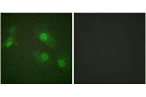 Immunofluorescence analysis of HeLa cells treated with EGF 200nM 5', using NF-kappaB p105/p50 (Phospho-Ser927) Antibody.