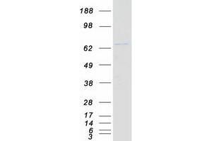 Western Blotting (WB) image for DEAD (Asp-Glu-Ala-Asp) Box Polypeptide 41 (DDX41) protein (Myc-DYKDDDDK Tag) (ABIN2719284)
