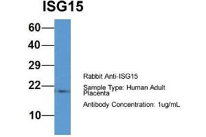 Western Blotting (WB) image for anti-ISG15 Ubiquitin-Like Modifier (ISG15) (Middle Region) antibody (ABIN2788047)