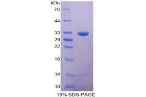 SDS-PAGE (SDS) image for Nitric Oxide Synthase Trafficker (NOSTRIN) (AA 6-245) protein (His tag) (ABIN2126104)
