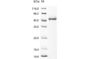 Interleukin 4 (IL4) (AA 25-153), (full length) (Active) protein (hFc-Myc Tag)