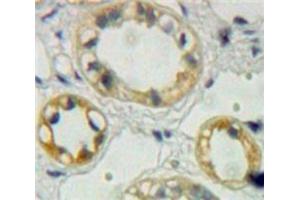 Used in DAB staining on fromalin fixed paraffin-embedded Kidney tissue (EPHA1 antibody  (AA 716-960))