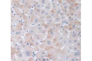 IHC-P analysis of Human Tissue, with DAB staining. (PPARD antibody  (AA 260-426))