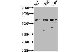 Western Blot Positive WB detected in: U87 whole cell lysate, K562 whole cell lysate, 293T whole cell lysate All lanes: ZNF37A antibody at 2. (ZNF37A antibody  (AA 263-386))