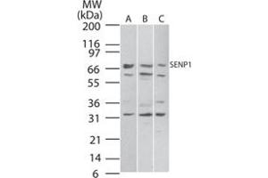 Western blot analysis of SENP1 in A) Daudi, B) HeLa and C) NIH/3T3 cell lysate. (SENP1 antibody  (AA 578-590))