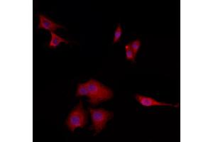 ABIN6265689 and ABIN6272867 staining HepG2 by IF/ICC. (TPI1 antibody  (C-Term))