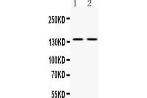 Western blot analysis of ABL2 expression in mouse brain extract ( Lane 1) and HELA whole cell lysates ( Lane 2).
