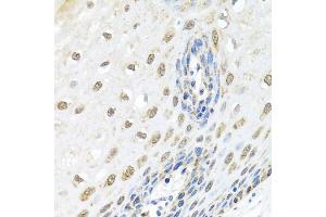 Immunohistochemistry of paraffin-embedded human esophagus using ELAC2 antibody (ABIN5974286) at dilution of 1/100 (40x lens). (ELAC2 antibody)