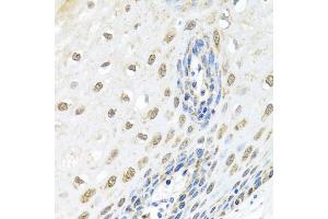 Immunohistochemistry of paraffin-embedded human esophagus using ELAC2 antibody (ABIN5974286) at dilution of 1/100 (40x lens). (ELAC2 antibody)