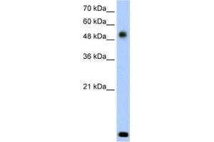 Western Blotting (WB) image for anti-Radical S-Adenosyl Methionine Domain Containing 2 (RSAD2) antibody (ABIN2462622) (RSAD2 antibody)