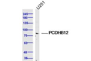 U251 lysates probed with PCDHB12 Polyclonal Antibody, Unconjugated  at 1:300 dilution and 4˚C overnight incubation.