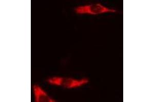 ABIN6278588 staining COLO205 cells by IF/ICC. (GAL4 antibody  (N-Term))