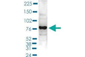Western Blot (Cell lysate) analysis of 40 ug nuclear extracts of Hela cells. (PAPOLA antibody  (C-Term))