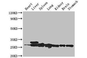 Western Blot Positive WB detected in: Mouse heart tissue, Mouse liver tissue, Mouse spleen tissue, Mouse lung tissue, Mouse kidney tissue, Mouse brain tissue, Mouse stomach tissue All lanes: SWI5 antibody at 3 μg/mL Secondary Goat polyclonal to rabbit IgG at 1/50000 dilution Predicted band size: 27 kDa Observed band size: 27, 29 kDa (SWI5 antibody  (AA 54-112))