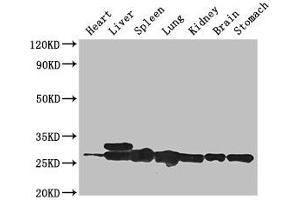Western Blot Positive WB detected in: Mouse heart tissue, Mouse liver tissue, Mouse spleen tissue, Mouse lung tissue, Mouse kidney tissue, Mouse brain tissue, Mouse stomach tissue All lanes: SWI5 antibody at 3 μg/mL Secondary Goat polyclonal to rabbit IgG at 1/50000 dilution Predicted band size: 27 kDa Observed band size: 27, 29 kDa