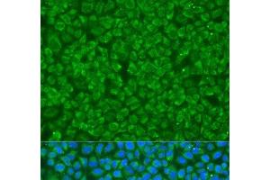 Immunofluorescence analysis of U2OS cells using GOSR1 Polyclonal Antibody at dilution of 1:100. (GS28 antibody)