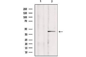 Western blot analysis of extracts from mouse brain, using CCDC109A Antibody.