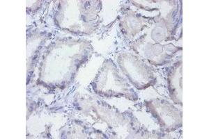 Immunohistochemistry of paraffin-embedded human prostate tissue using ABIN7155134 at dilution of 1:100 (SYNCRIP antibody  (AA 2-191))
