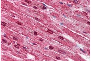 Human Heart (formalin-fixed, paraffin-embedded) stained with SPTLC2 antibody ABIN790286 at 5 µg/ml followed by biotinylated goat anti-rabbit IgG secondary antibody ABIN481713, alkaline phosphatase-streptavidin and chromogen. (SPTLC2 antibody  (AA 548-562))