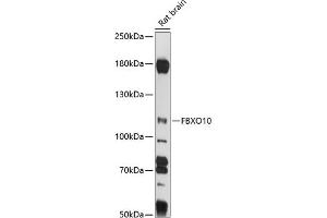 FBXO10 抗体  (AA 1-180)
