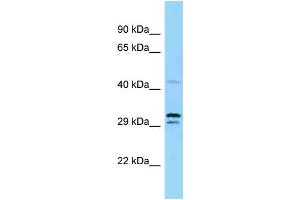 Western Blotting (WB) image for anti-Ubiquitin-Like Modifier Activating Enzyme 5 (UBA5) (N-Term) antibody (ABIN2783950) (UBA5 antibody  (N-Term))