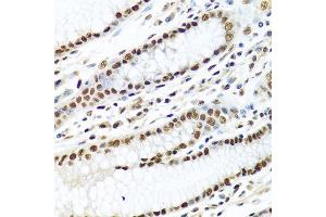 Immunohistochemistry of paraffin-embedded human stomach using METTL3 antibody at dilution of 1:100 (40x lens).