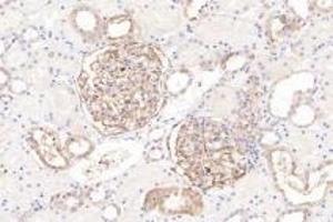 Immunohistochemistry analysis of paraffin-embedded human kidney using Integrin alpha V (ABIN7074314) at dilution of 1: 1000 (CD51 antibody)