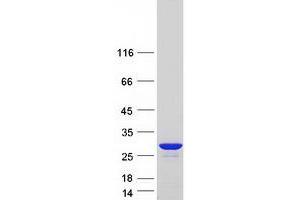 Western Blotting (WB) image for Peroxiredoxin 1 (PRDX1) (Transcript Variant 3) protein (Myc-DYKDDDDK Tag) (ABIN2728700)