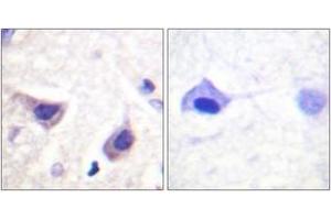Immunohistochemistry analysis of paraffin-embedded human brain tissue, using JAK3 (Ab-785) Antibody. (JAK3 antibody  (AA 751-800))