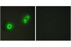 Immunofluorescence analysis of A549 cells, using Ik3-2 Antibody. (CABLES2 antibody  (AA 91-140))