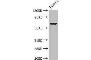 Western Blot Positive WB detected in: Jurkat whole cell lysate All lanes: SLC38A9 antibody at 3. (SLC38A9 antibody  (AA 1-119))