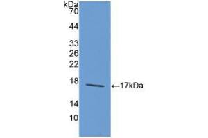 Figure. (Laminin alpha 1 antibody  (AA 1156-1276))