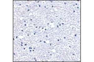 Immunohistochemistry of PD-1 in human brain tissue with this product at 5 μg/ml. (PD-1 antibody  (Center))