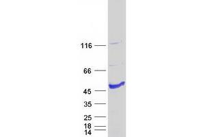 Western Blotting (WB) image for Aryl Hydrocarbon Receptor Interacting Protein-Like 1 (AIPL1) (Transcript Variant 1) protein (Myc-DYKDDDDK Tag) (ABIN2714489)