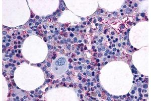 Anti-F2RL3 / PAR4 antibody  ABIN1048594 IHC staining of human bone marrow. (F2RL3 antibody  (Cytoplasmic Domain))
