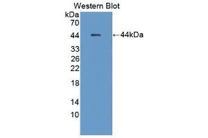 Western blot analysis of the recombinant protein. (HSF4 antibody  (AA 171-284))