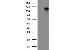 HEK293T cells were transfected with the pCMV6-ENTRY control (Left lane) or pCMV6-ENTRY PTK7 (Right lane) cDNA for 48 hrs and lysed. (PTK7 antibody)