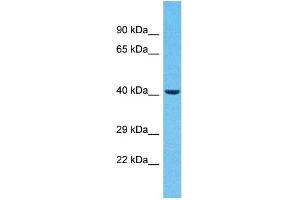 Host:  Rabbit  Target Name:  ZNF232  Sample Type:  Breast Tumor lysates  Antibody Dilution:  1. (ZNF232 antibody  (C-Term))
