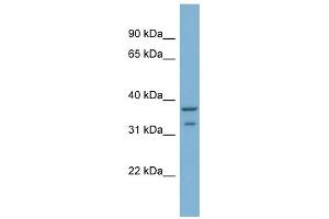 WB Suggested Anti-RALGPS2 Antibody Titration: 0. (RALGPS2 antibody  (C-Term))