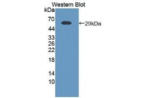 Detection of Recombinant VF, Human using Polyclonal Antibody to Visfatin (VF) (NAMPT antibody  (AA 1-491))