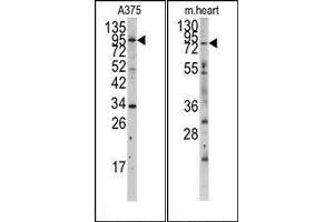 Image no. 1 for anti-Myosin Light Chain Kinase (MYLK) (N-Term) antibody (ABIN360382) (MYLK antibody  (N-Term))