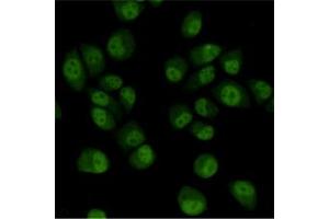 Immunocytochemistry staining of HeLa cells fixed with 4 % Paraformaldehyde and using TBLR1 mouse mAb (dilution 1:200). (TBL1XR1 antibody)