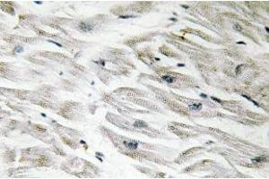 Immunohistochemistry (IHC) analyzes of CPI-17 antibody in paraffin-embedded human heart tissue. (CPI-17 antibody)