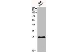Western blot analysis of 293T Hela VEC KB mouse-kidney lysate, antibody was diluted at 500. (IL-19 antibody  (AA 51-100))